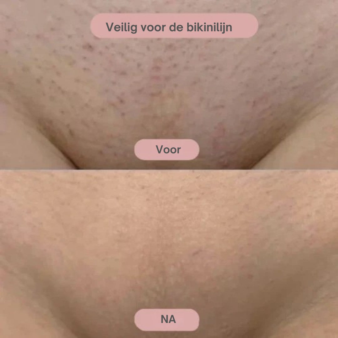 EasySmooth™ 2-in-1 Ladyshave  – Intiem scheren zonder irritatie, snijwondjes of stress